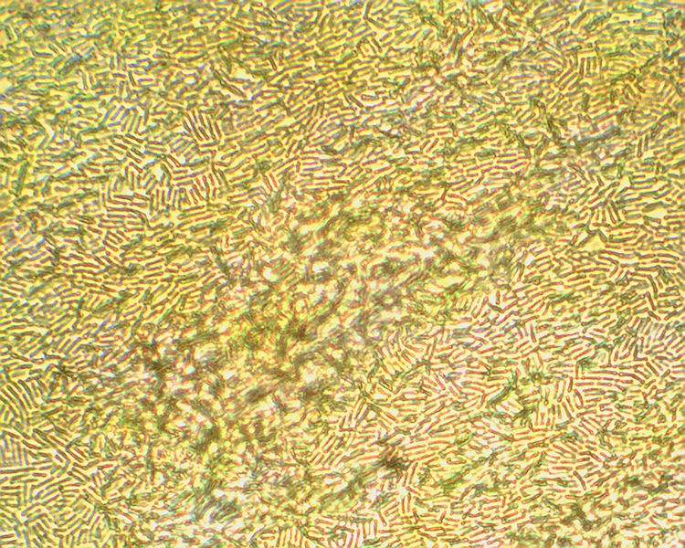 File:Lactobacillus 1.jpg